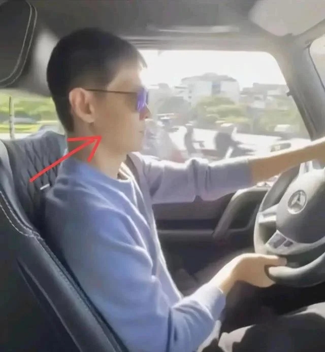 车祸三个月后林志颖再次开车,曝光现场,竖起大拇指表扬自己。
